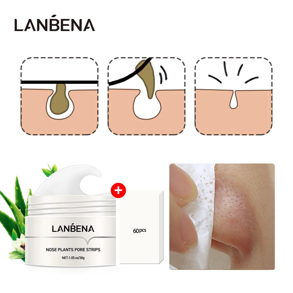 LANBENA™ Mitesser-Creme | Mühelos Mitesser entfernen