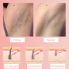 Clean-Skin-Ultra® | IPL Haarentferner